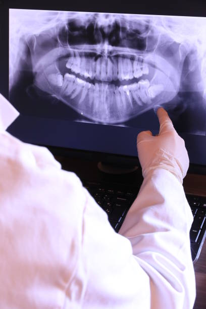 Best Emergency Wisdom Teeth Removal in Monmouth Beach, NJ
